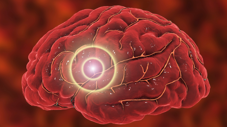 Det finns teorier forskning kring att hjärnstammen och trigeminusnerven är inblandade.  Foto: Shutterstock
